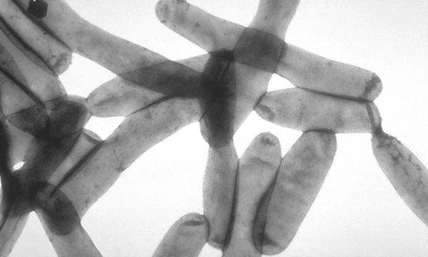 Il rischio invisibile negli impianti idrici: come prevenire e gestire la Legionella in azienda.